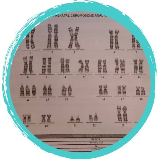 trisomy 13 chromosome analysis