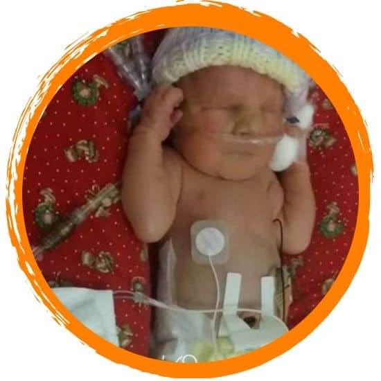 Trisomy 13 The Story Of Addison Faith Terminations Remembered