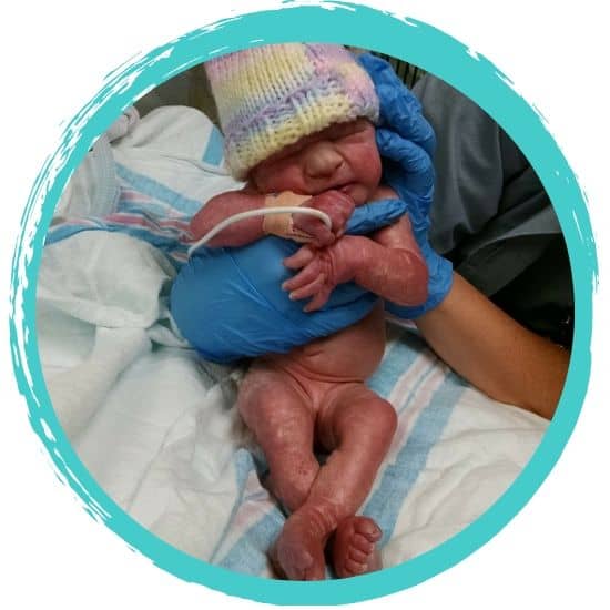 Trisomy 13 – The Story of Addison Faith