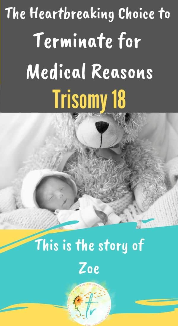 trisomy 18 edwards syndrome tfmr