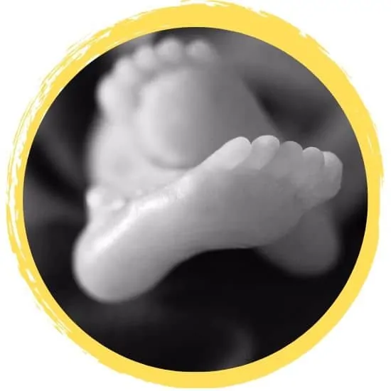 Anencephaly – The Story of Elias Micheal Arnott Anencephaly – The Story of Elias Micheal Arnott