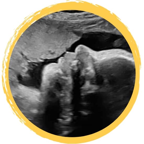 Baby V#3 Week 31 Update