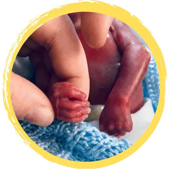 The Story of Sebastian – Trisomy 18 TFMR