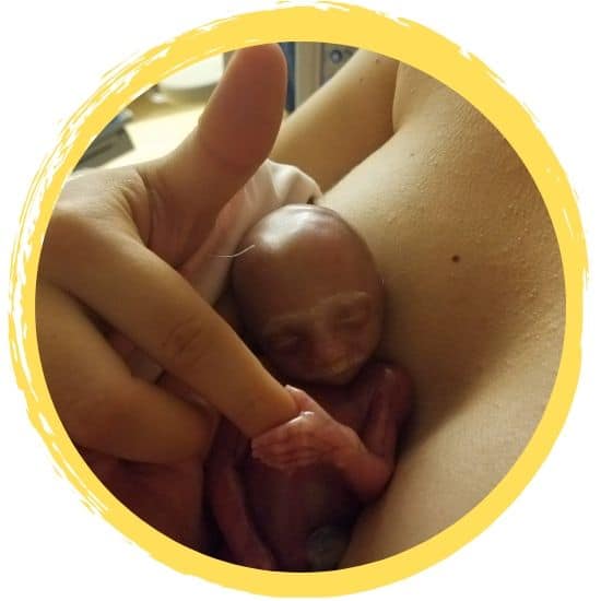 april rey 20 weeks gestation